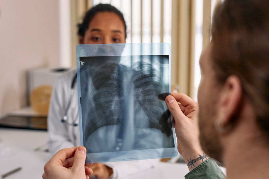 Przewlekła obturacyjna choroba płuc: co musisz wiedzieć o POChP